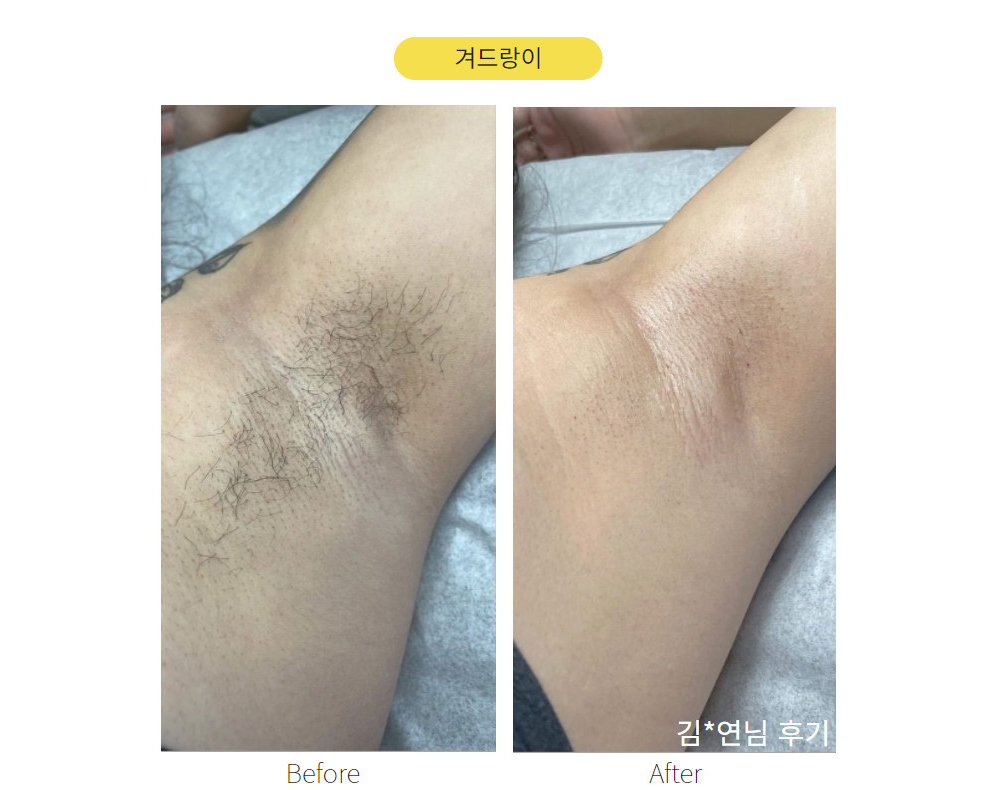 악세사리 상품상세 이미지-S1L14